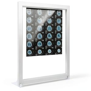 LED X Ray View Box DJJYCTNM Adjustable Brightness Flicker‑Free Light-0