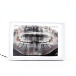 NSKI Lab Equipment X-Ray Film Illuminator Light Box 30×20cm Display-0