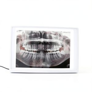 NSKI Lab Equipment X-Ray Film Illuminator Light Box 30×20cm Display-0