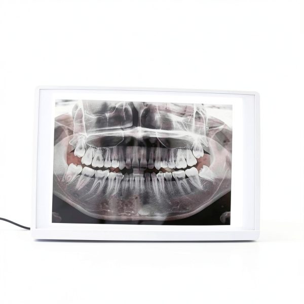 NSKI Lab Equipment X-Ray Film Illuminator Light Box 30×20cm Display-0