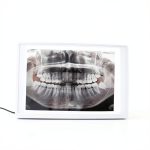X-Ray Film Illuminator Light Box by Global Dental Radiology-0