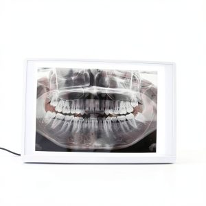 X-Ray Film Illuminator Light Box by Global Dental Radiology-0