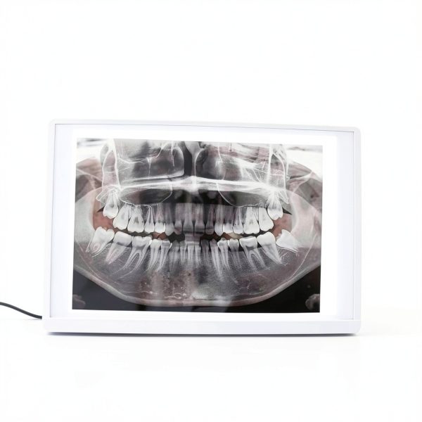 X-Ray Film Illuminator Light Box by Global Dental Radiology-0