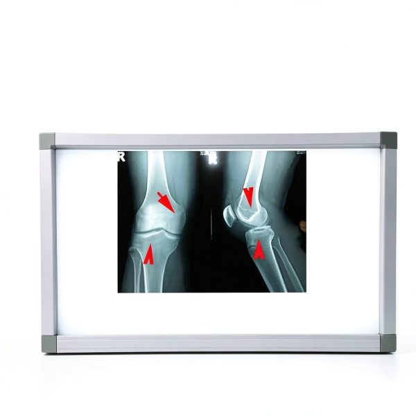 X Ray LED Film Viewer ZXDRYBHD Portable Illuminator with Acrylic Frame-5